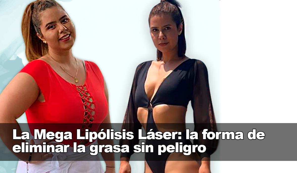 La Mega Lipólisis Láser: la forma de eliminar la grasa sin peligro